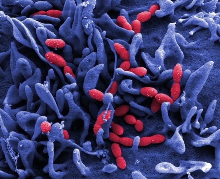 Pneumocoques