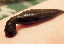 Les soins de beauté les plus dégoûtants
