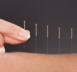 Acupuncture pour la dépendance à l'alcool