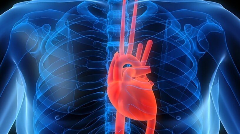 Cardiologie et chirurgie cardiaque
