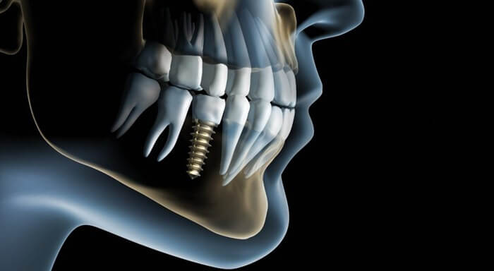 Dentisterie et implantologie