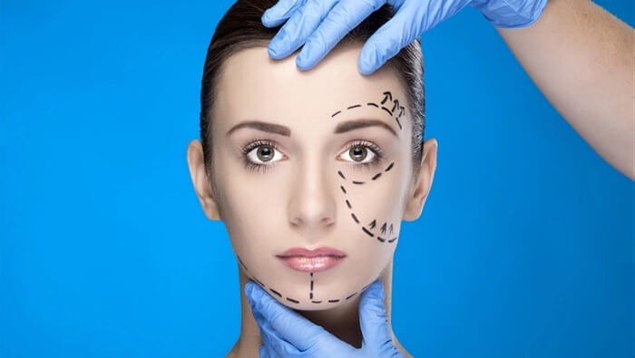 Chirurgie plastique
