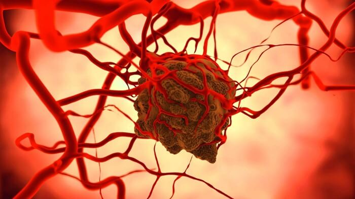 Oncologie
