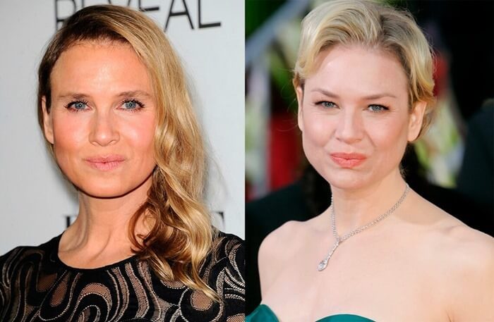 Renee Zellweger avant et après la chirurgie plastique