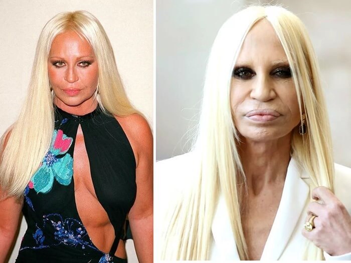 Il ressemblait à Donatella Versace dans sa jeunesse