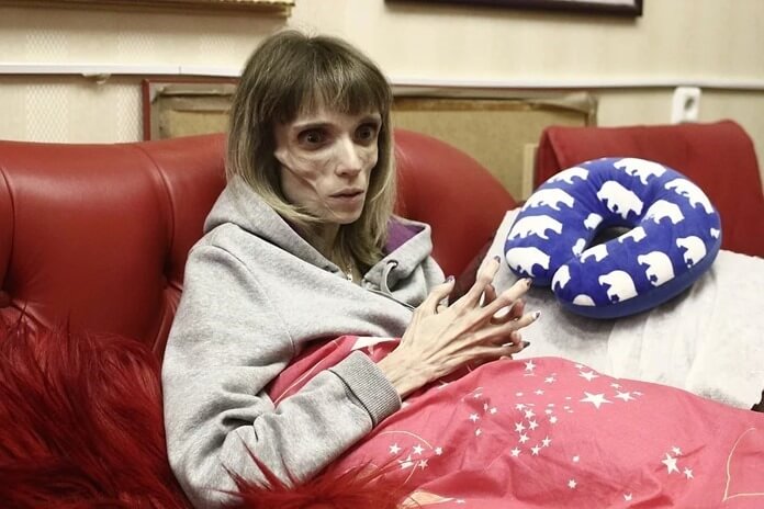 Kristina Koryagina est la femme la plus mince