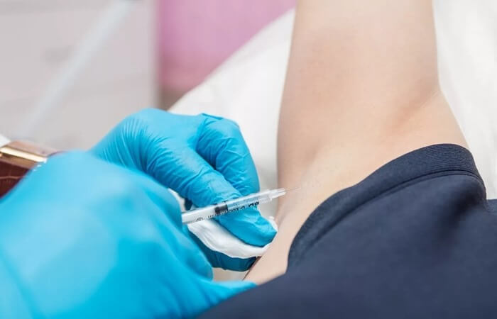 Injections de Botox pour l'hyperhidrose