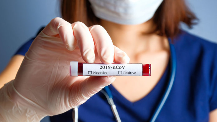 Coronavirus 2019-nCoV